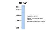 SF3A1 Antibody in Western Blot (WB)