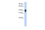 TIA-1 Antibody in Western Blot (WB)