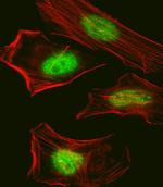 SUMO2/SUMO3 Antibody in Immunocytochemistry (ICC/IF)