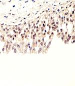 SUMO2/SUMO3 Antibody in Immunohistochemistry (Paraffin) (IHC (P))