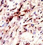 SUMO2/SUMO3 Antibody in Immunohistochemistry (Paraffin) (IHC (P))