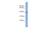 Prostate Specific Acid Phosphatase Antibody in Western Blot (WB)