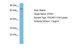 GTSE1 Antibody in Western Blot (WB)