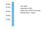 GTSE1 Antibody in Western Blot (WB)