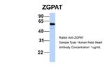 ZGPAT Antibody in Western Blot (WB)