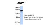 ZGPAT Antibody in Western Blot (WB)