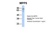 MPP5 Antibody in Western Blot (WB)