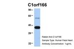 MUL1 Antibody in Western Blot (WB)