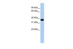 MUL1 Antibody in Western Blot (WB)