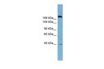 ABCC11 Antibody in Western Blot (WB)