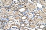 PSEN2 Antibody in Immunohistochemistry (IHC)