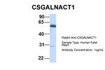 CSGALNACT1 Antibody in Western Blot (WB)