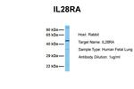 IFNLR1 Antibody in Western Blot (WB)