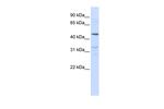 IFNLR1 Antibody in Western Blot (WB)