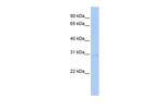 STK16 Antibody in Western Blot (WB)