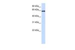 PAPSS2 Antibody in Western Blot (WB)