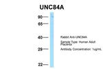 UNC84A Antibody in Western Blot (WB)