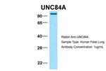 UNC84A Antibody in Western Blot (WB)