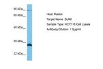 UNC84A Antibody in Western Blot (WB)