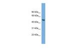 ABHD1 Antibody in Western Blot (WB)