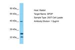 SPOP Antibody in Western Blot (WB)