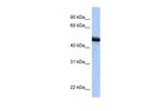 SPOP Antibody in Western Blot (WB)