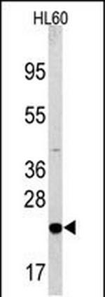 BAD Antibody in Western Blot (WB)