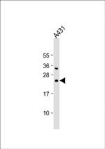 BAD Antibody in Western Blot (WB)