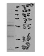 CETP Antibody in Western Blot (WB)