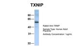 TXNIP Antibody in Western Blot (WB)