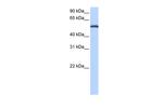 LACTB Antibody in Western Blot (WB)