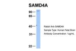 SAMD4A Antibody in Western Blot (WB)