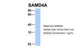 SAMD4A Antibody in Western Blot (WB)