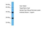 Arginase 2 Antibody in Western Blot (WB)