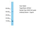 ApoA2 Antibody in Western Blot (WB)