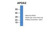 ApoA2 Antibody in Western Blot (WB)