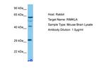 RIMKLB Antibody in Western Blot (WB)