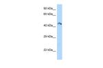 RIMKLB Antibody in Western Blot (WB)