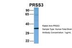 PRSS3 Antibody in Western Blot (WB)