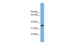 PRSS3 Antibody in Western Blot (WB)