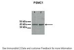 PSMC1 Antibody in Western Blot (WB)