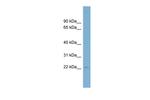 RSL24D1 Antibody in Western Blot (WB)