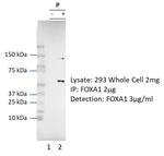 FOXA1 Antibody in Immunoprecipitation (IP)