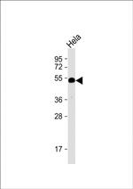 HTRA1 Antibody in Western Blot (WB)