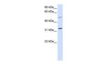 SHOX2 Antibody in Western Blot (WB)