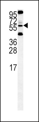 HTRA1 Antibody in Western Blot (WB)