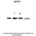 Skeletal Muscle Actin Antibody in Western Blot (WB)