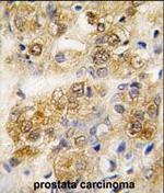 GRP78 Antibody in Immunohistochemistry (Paraffin) (IHC (P))