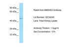 AMDHD2 Antibody in Western Blot (WB)