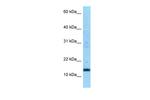 SDHC Antibody in Western Blot (WB)